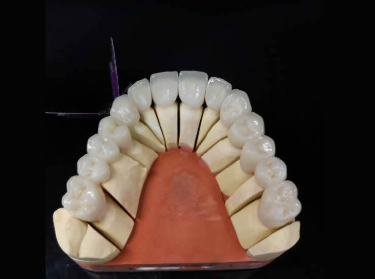 Zirconia